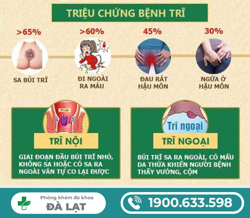 Hình ảnh minh họa